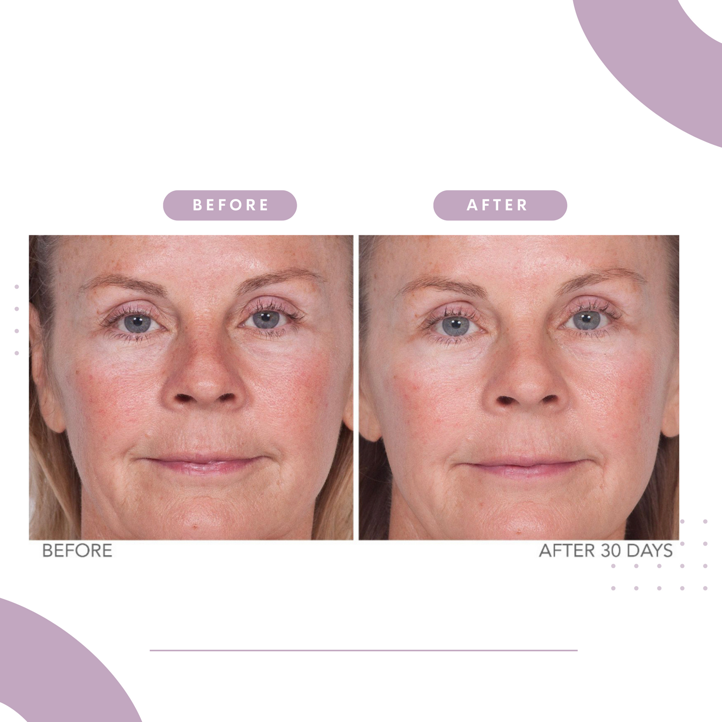 Reverse Lift Facial Cream