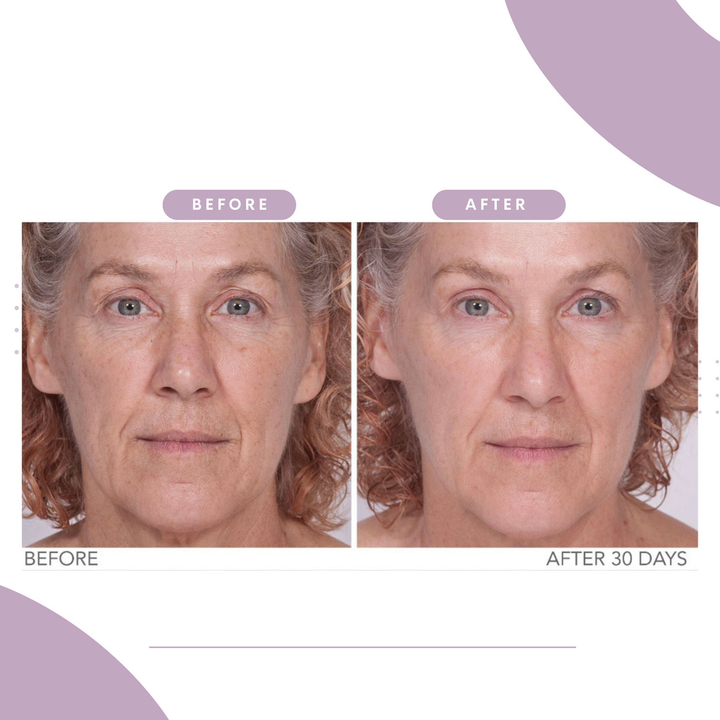Reverse Lift Facial Cream