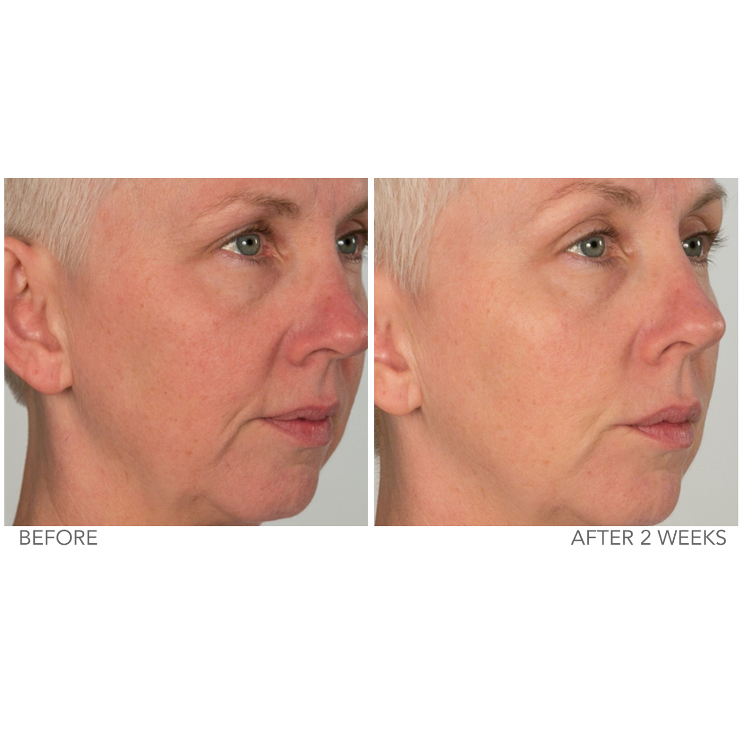 A Defiance Retinol Renewal Gel