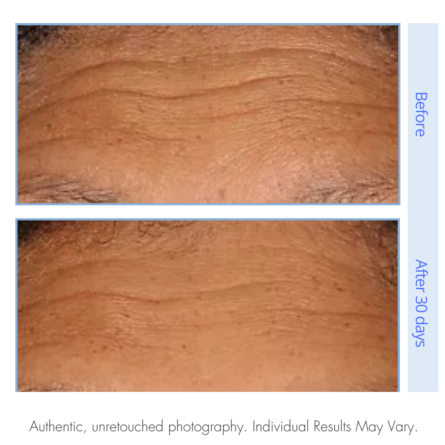 Before and after comparison of skin texture with text indicating time elapsed.
