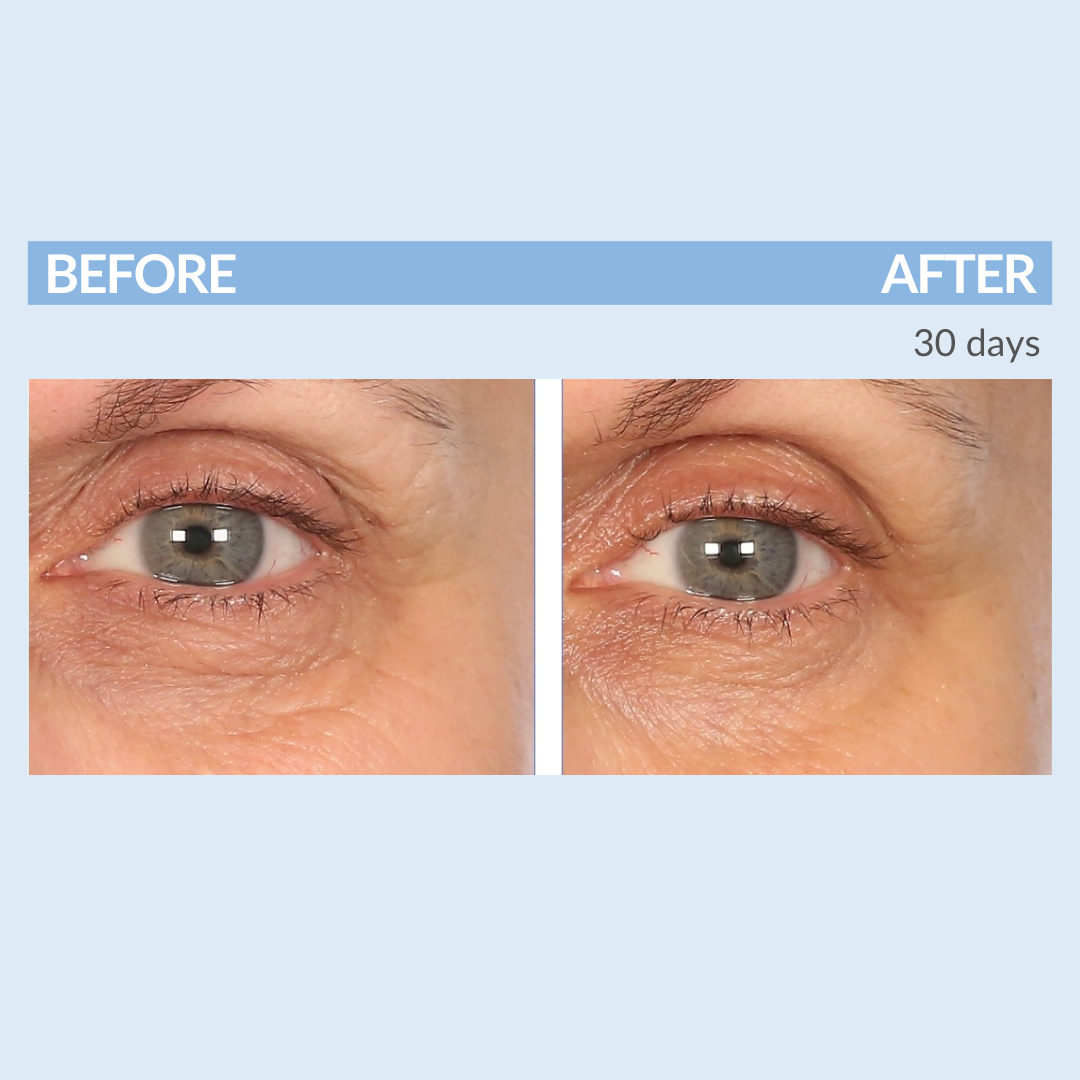 Eyetality Total Eye Care AM & PM with Tray