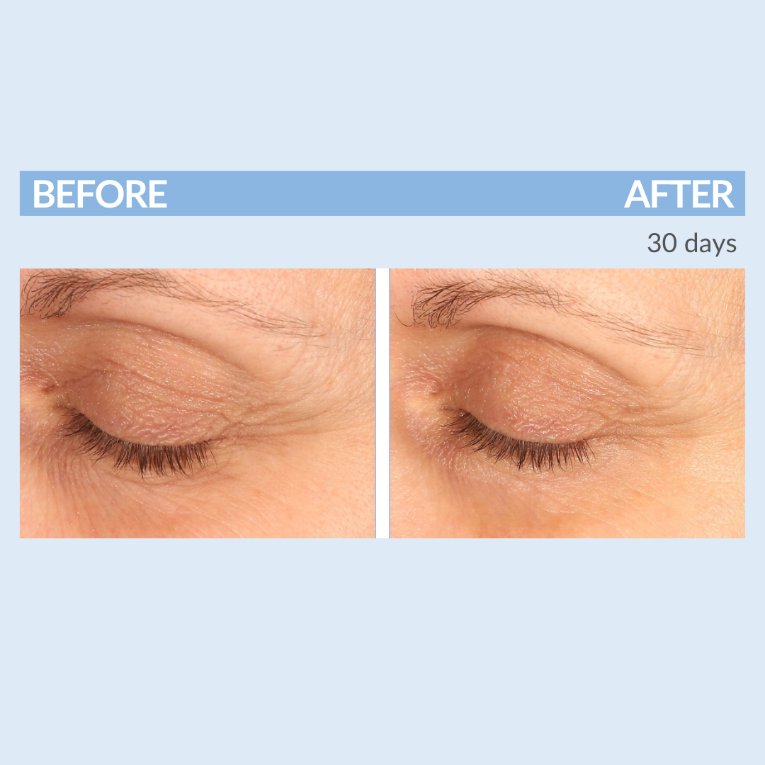 Eyetality Total Eye Care AM & PM with Tray
