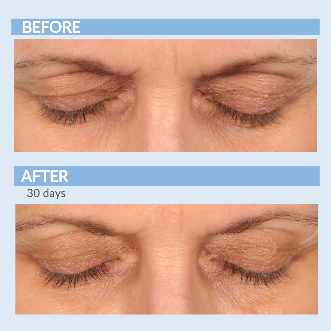 Eyetality Total Eye Care AM & PM with Tray