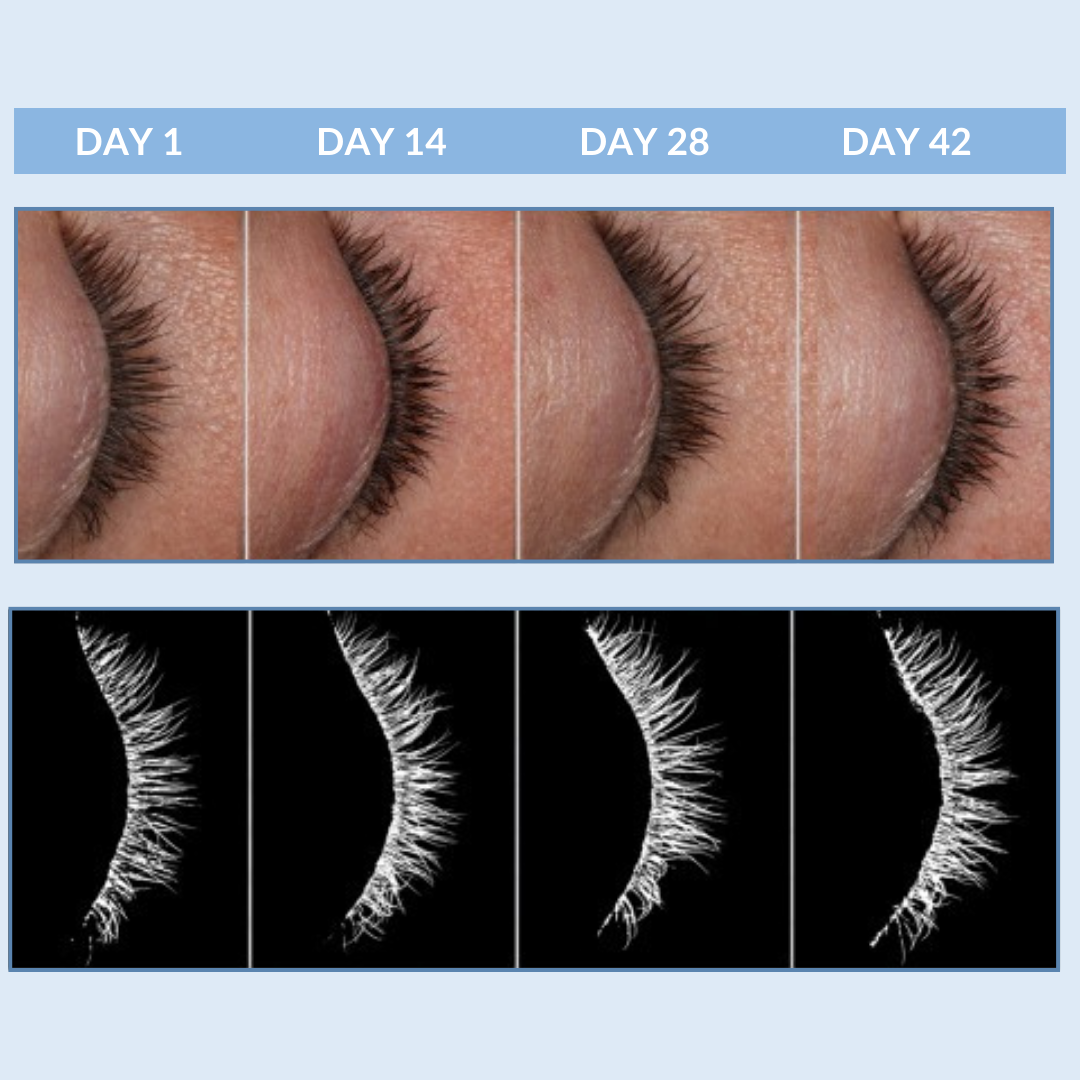 Eyetality Total Eye Care AM & PM with Tray