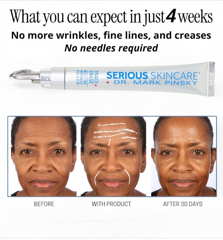 Trace + Erase Needle-Free Wrinkle Filler