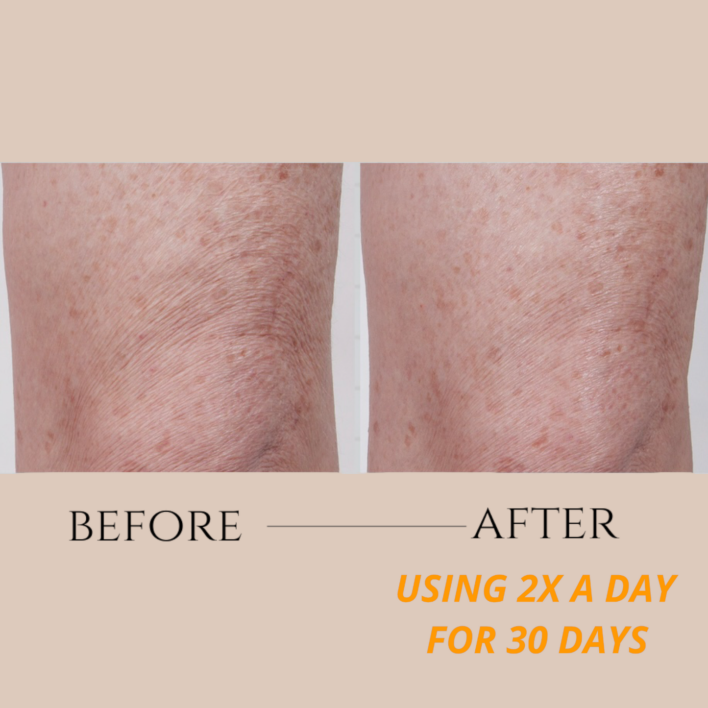 Dermal Crepe Resist Body Polish