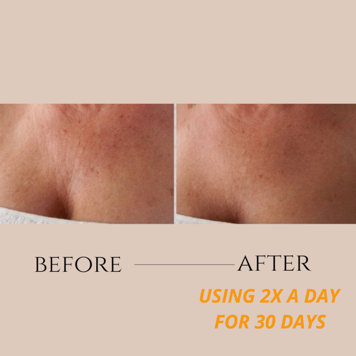 Dermal Crepe Resist Body Polish