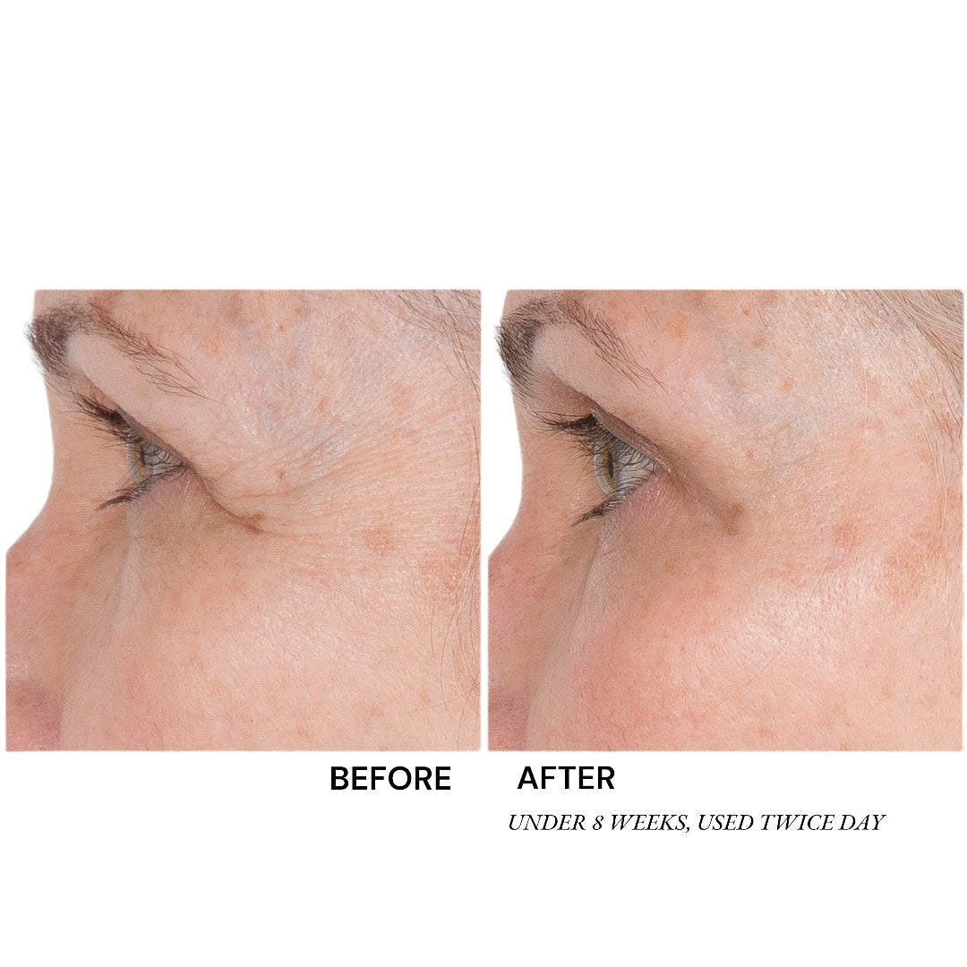 Dermal Crepe Resist Eye Cream