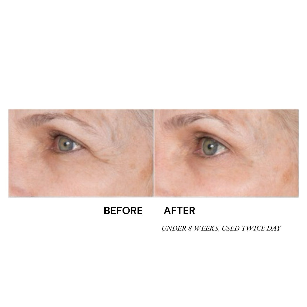 Dermal Crepe Resist Eye Cream