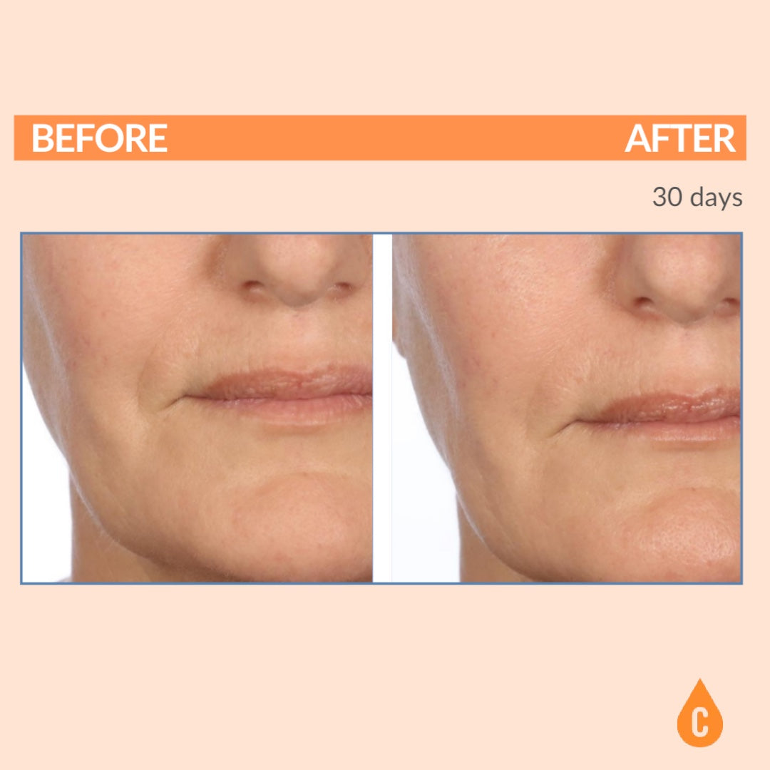 Serious C3 C Serum