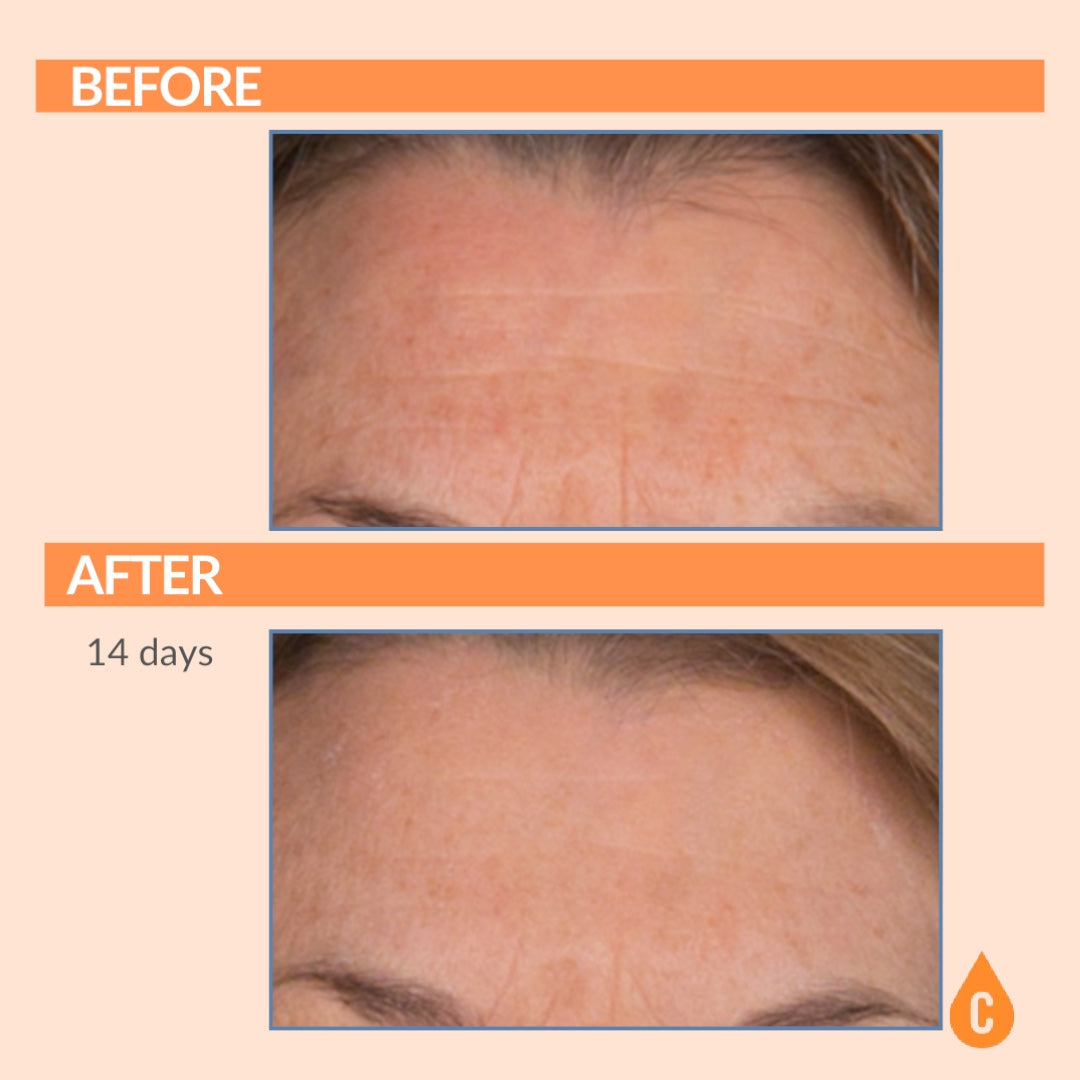 Serious C3 C Serum