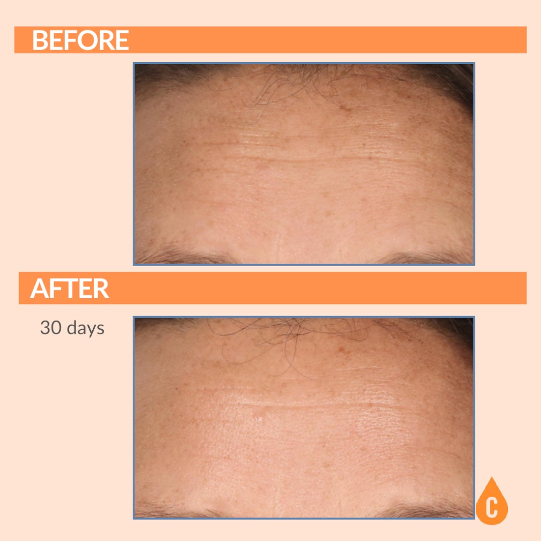 Serious C3 C Serum