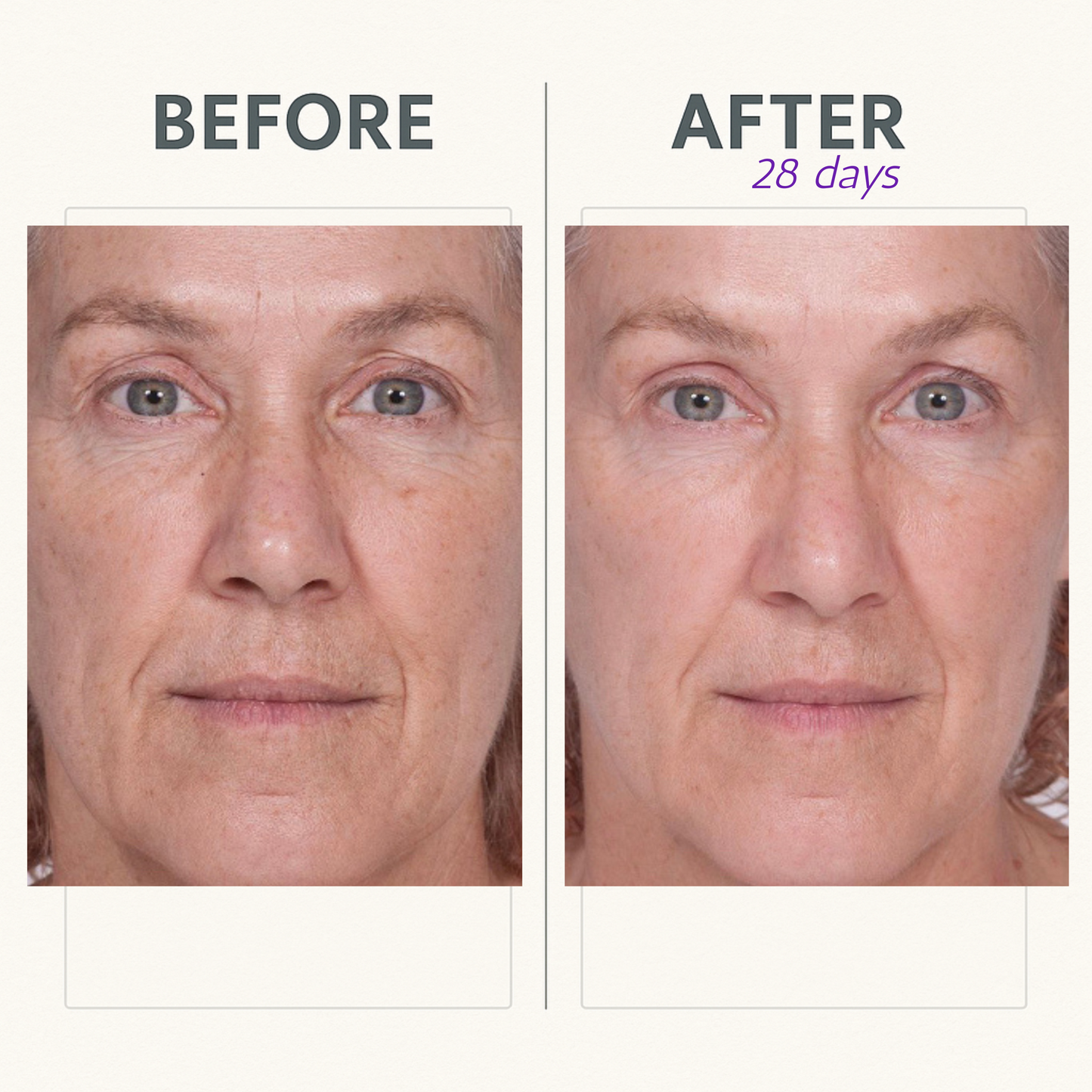 Reverse Lift Serum