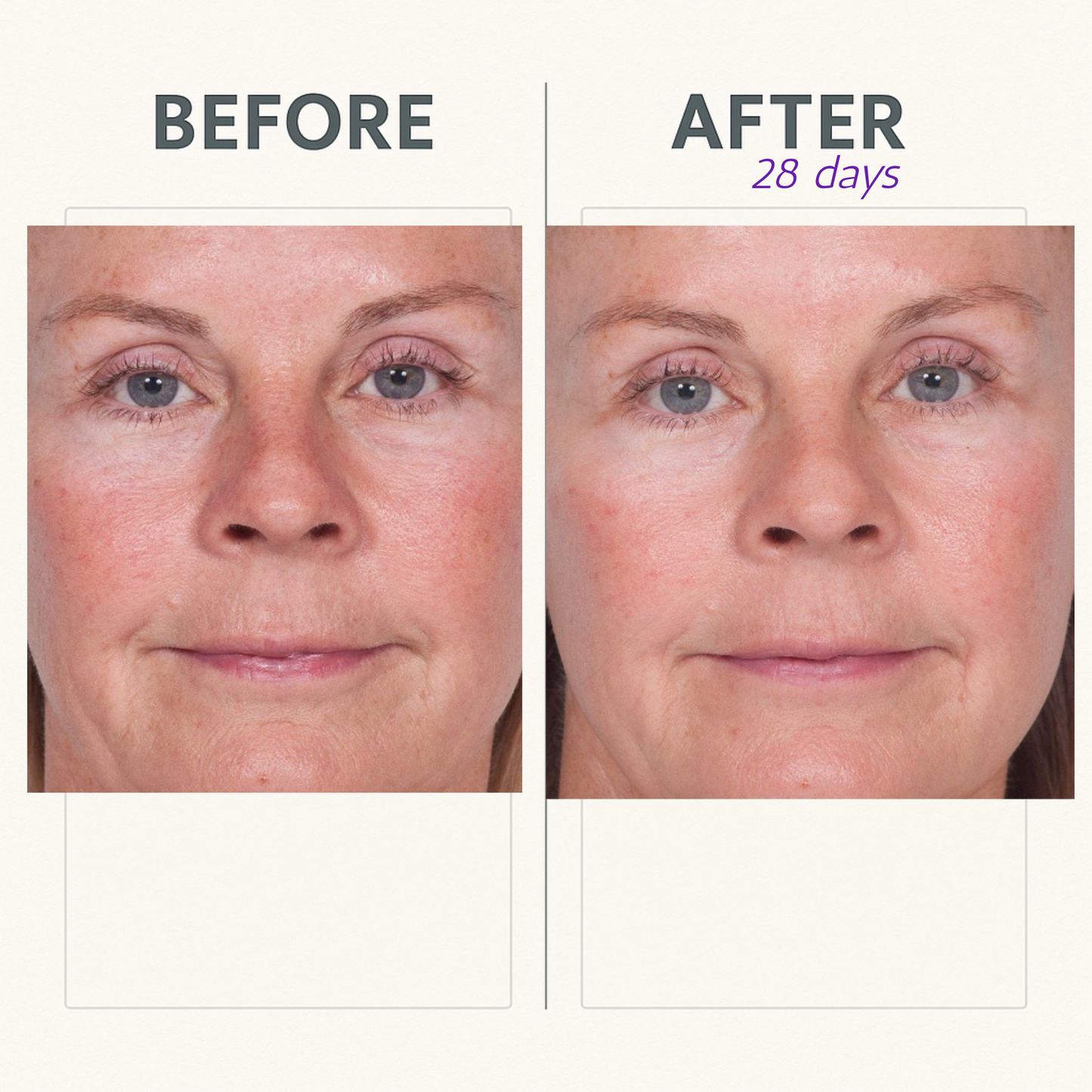 Reverse Lift Serum