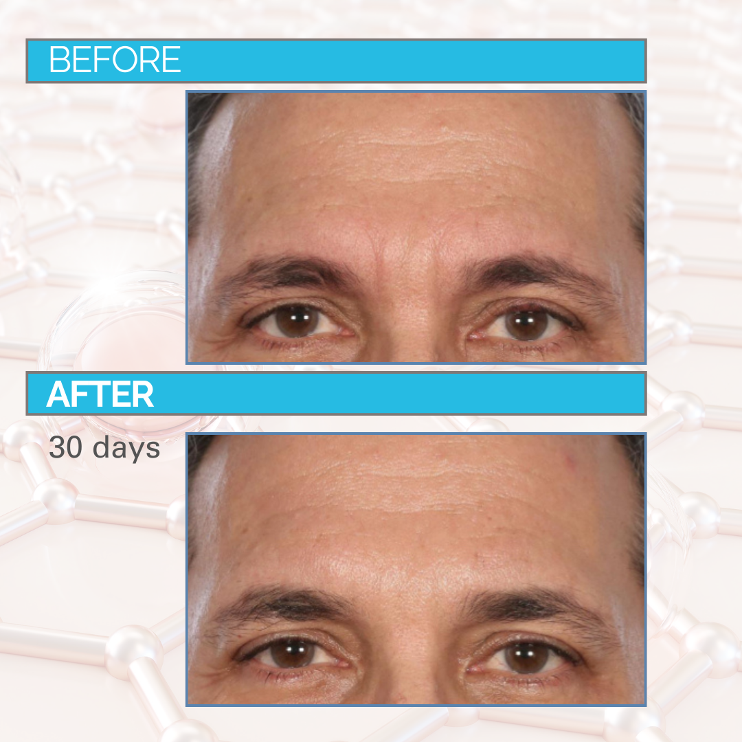 Dr. Mark Pinsky 3-Step System