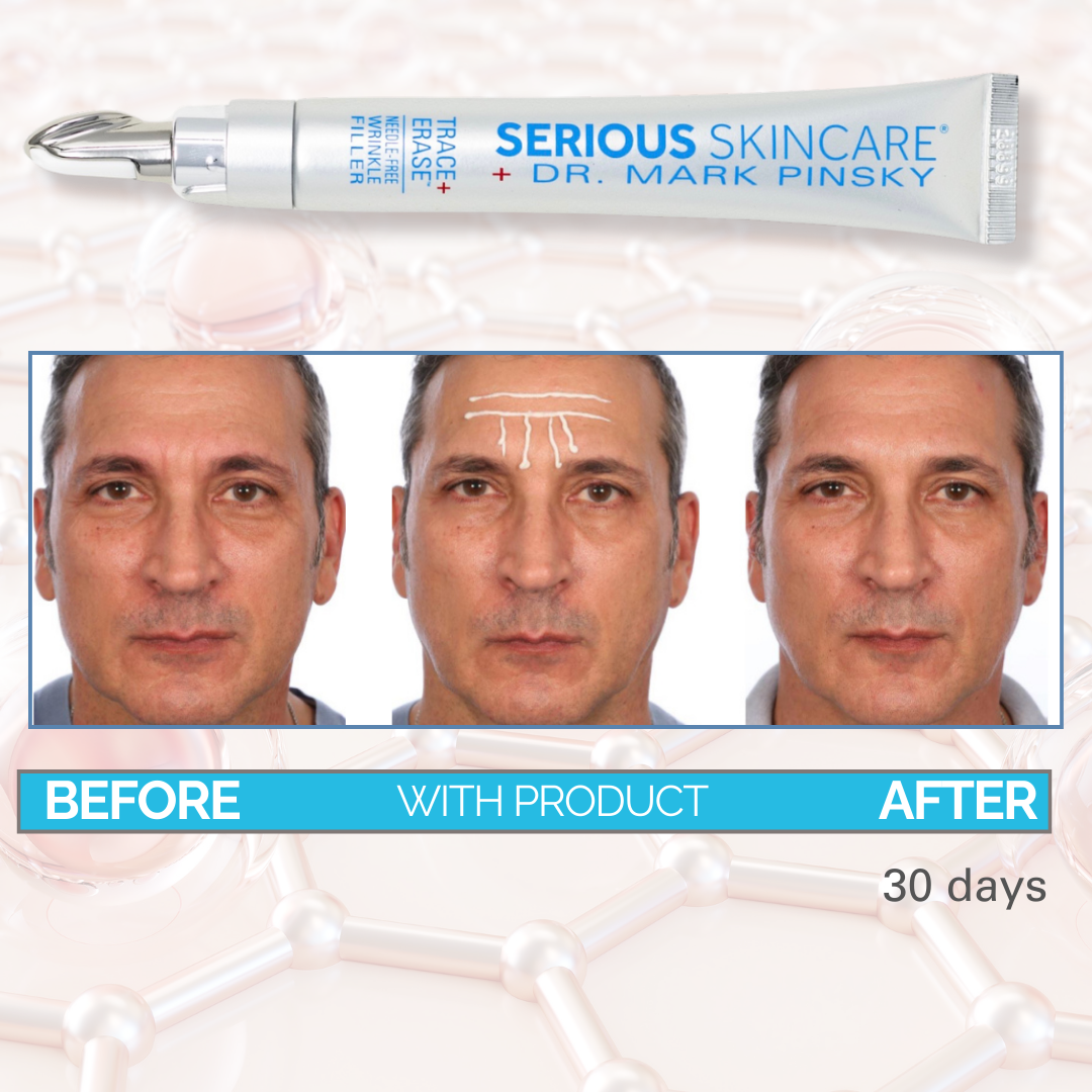 Dr. Mark Pinsky 3-Step System