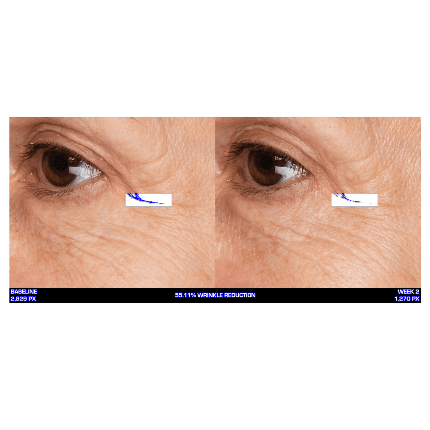 Ultra-Mare Eye Creme