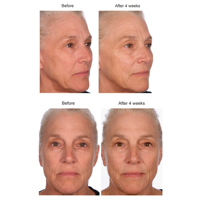 Black Pearl Deep Wrinkle Decrease Facial Cream