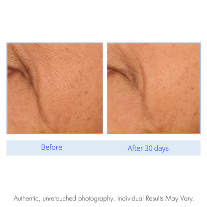 Before and after comparison of skin texture on a white background