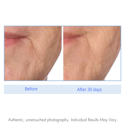 Before and after comparison of skin texture on a white background