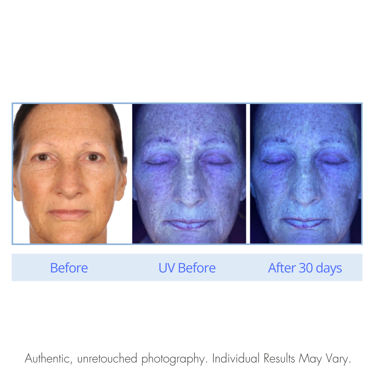 Before and after comparison of a person's skin under UV light with text indicating results after 30 days.  A Force.  A Defy.  Serious Skincare.