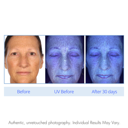 Before and after comparison of a person's skin under UV light with text indicating results after 30 days.  A Force.  A Defy.  Serious Skincare.
