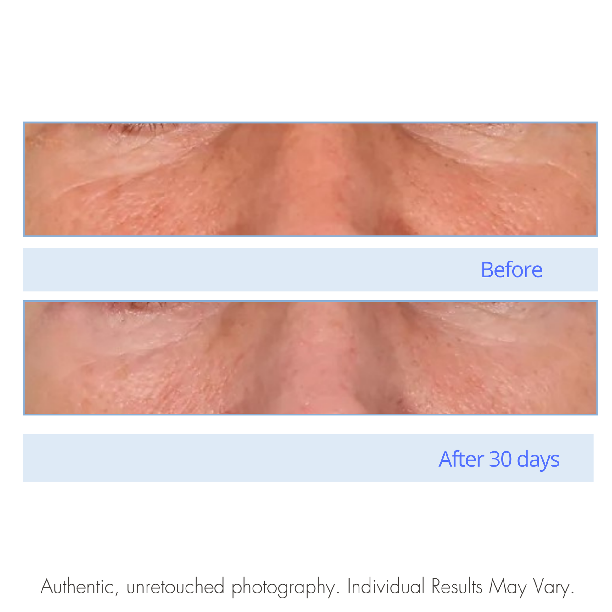 Before and after comparison of skin texture with a light blue separator labeled 'After 30 days'.