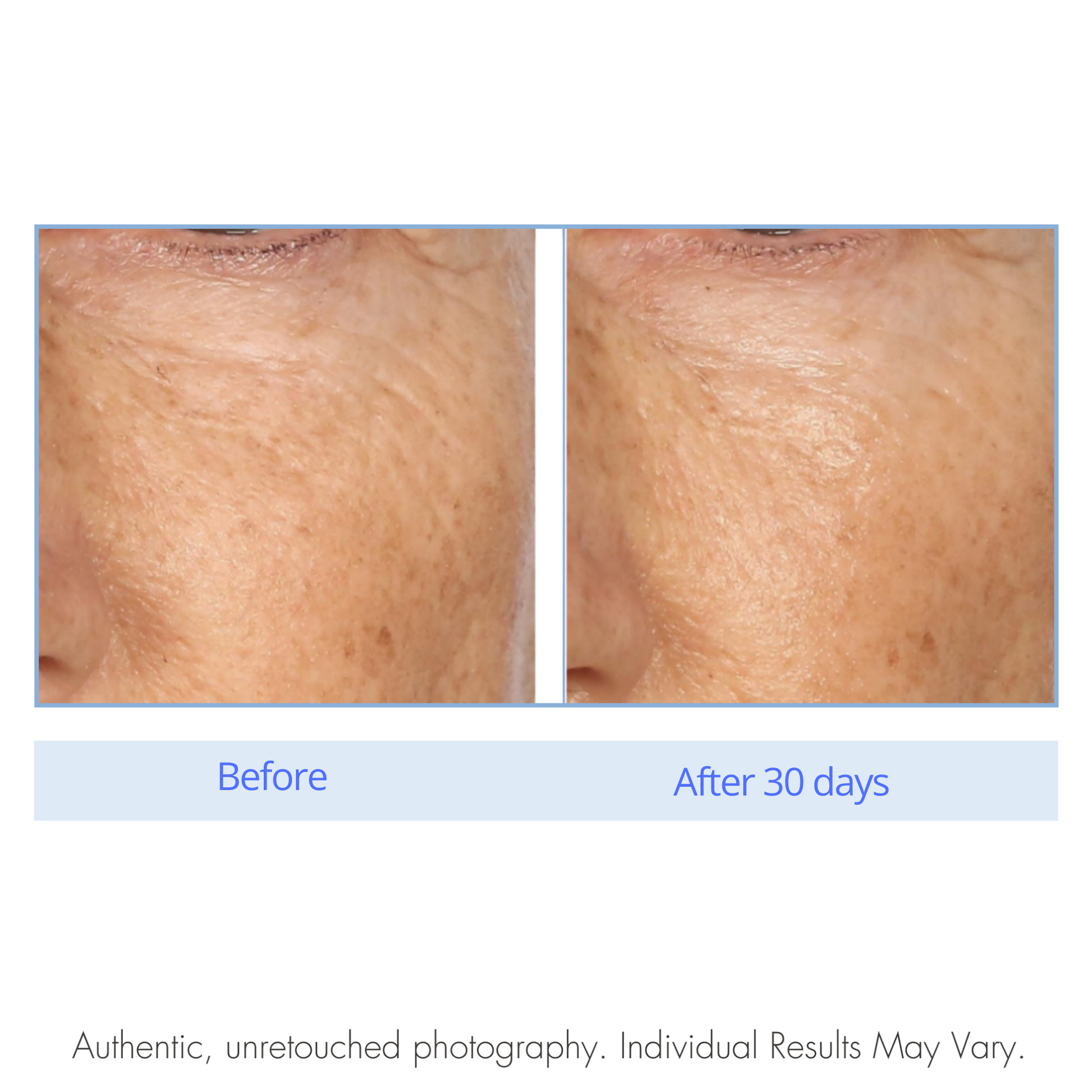 Before and after comparison of skin texture on a white background