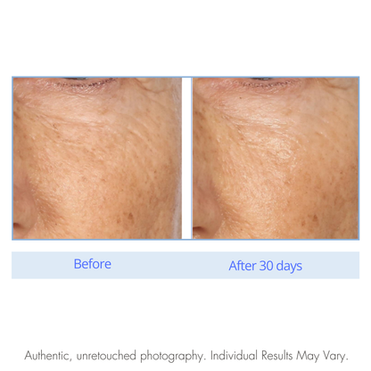 Before and after comparison of skin texture on a white background