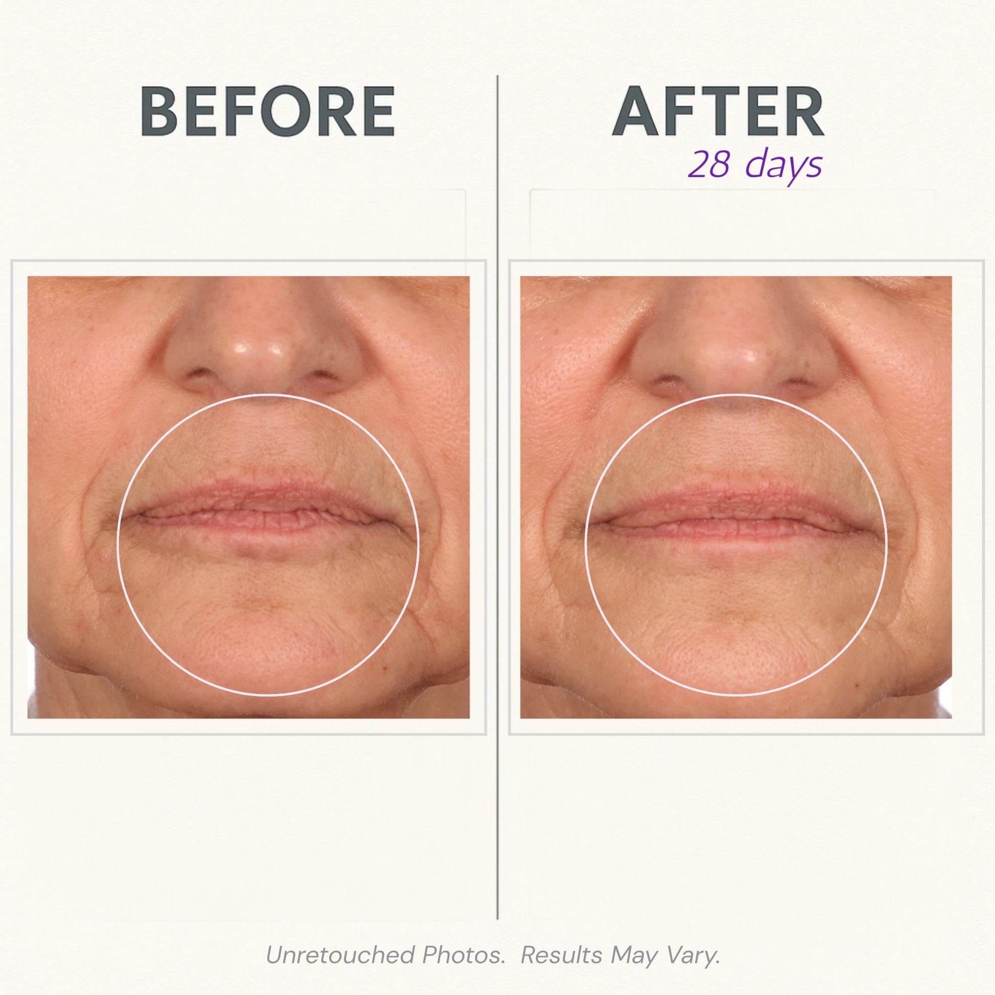 Serious Skincare Reverse Lift Face & Neck Cream with ARGIFIRM Amplified peptides to visibly firm, tighten and smooth sagging, crepey skin.