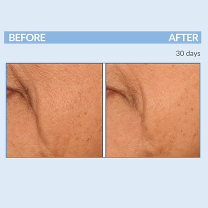 Before and After 30 Days A Defy