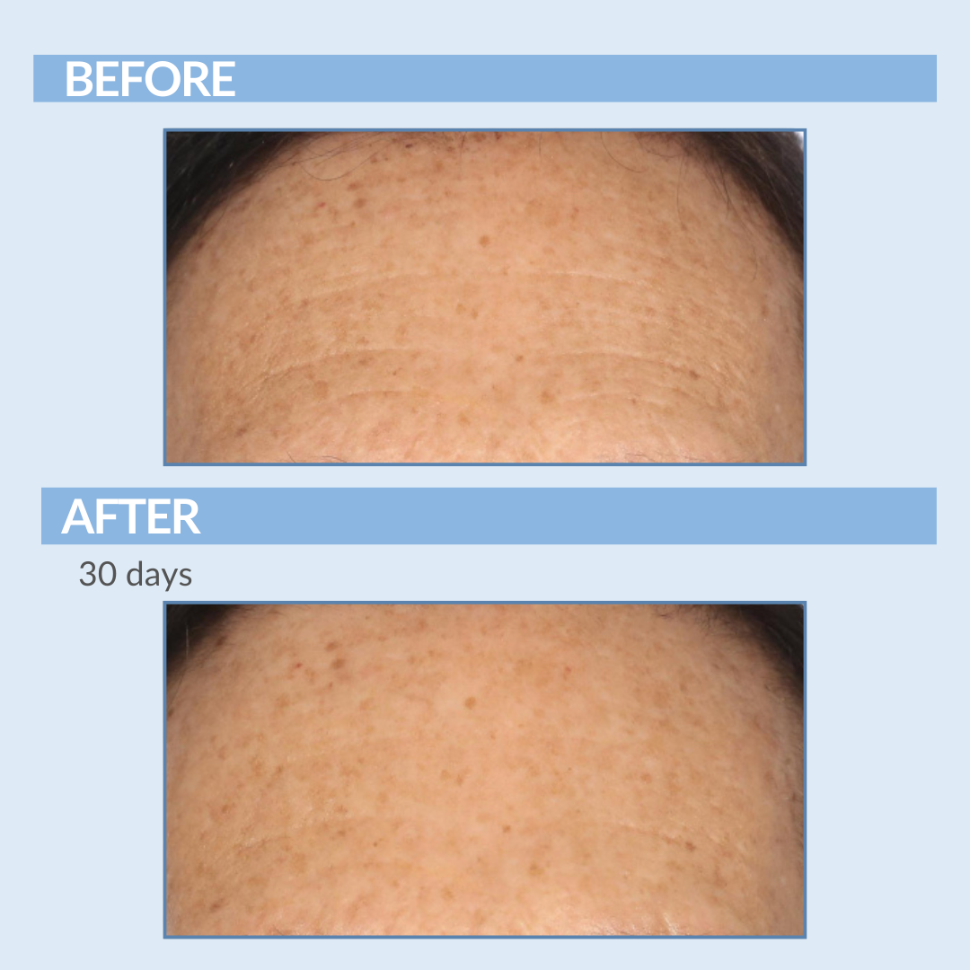 Before and After 30 Days A Defy