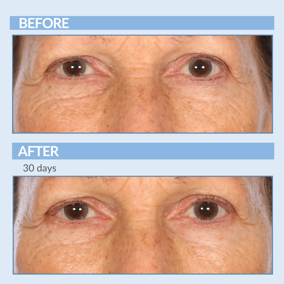 Before and After 30 Days A Defy