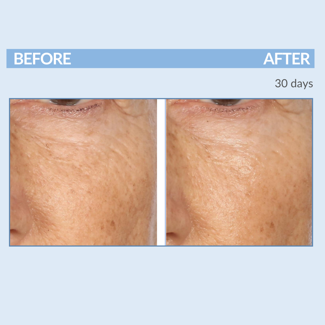 Before and After 30 Days A Defy