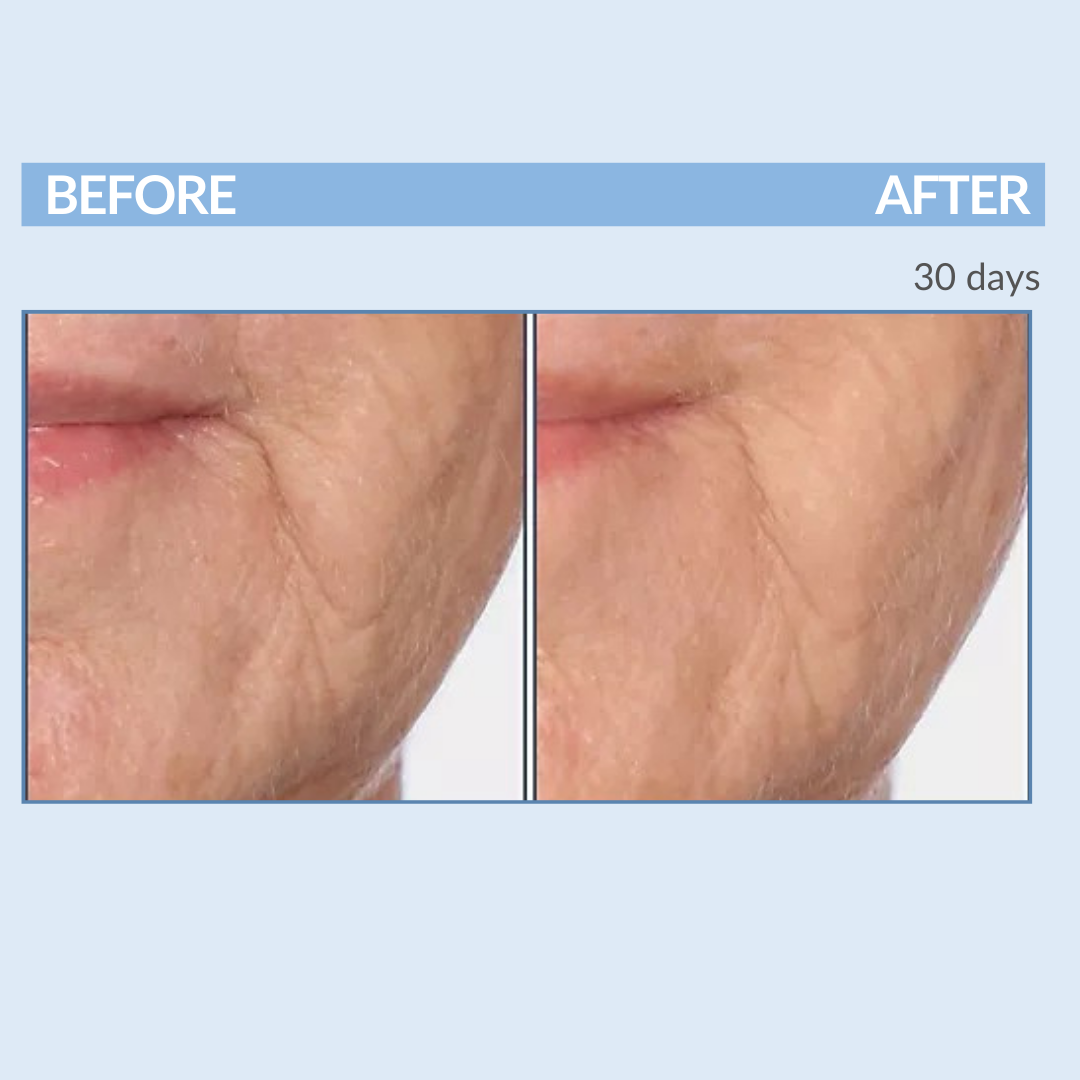 Before and After 30 Days A Defy