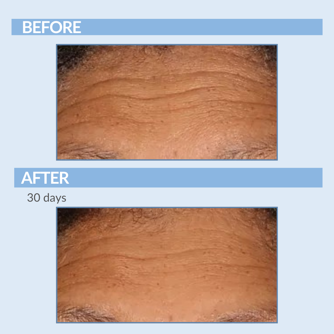 Before and After 30 Days A Defy
