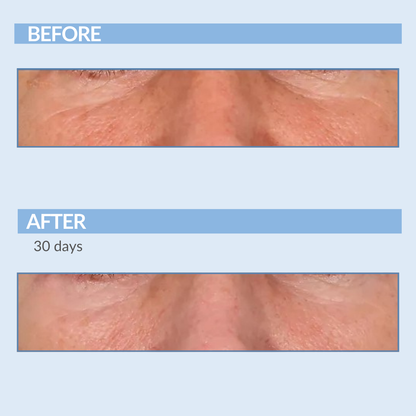 Before and After A-Eye