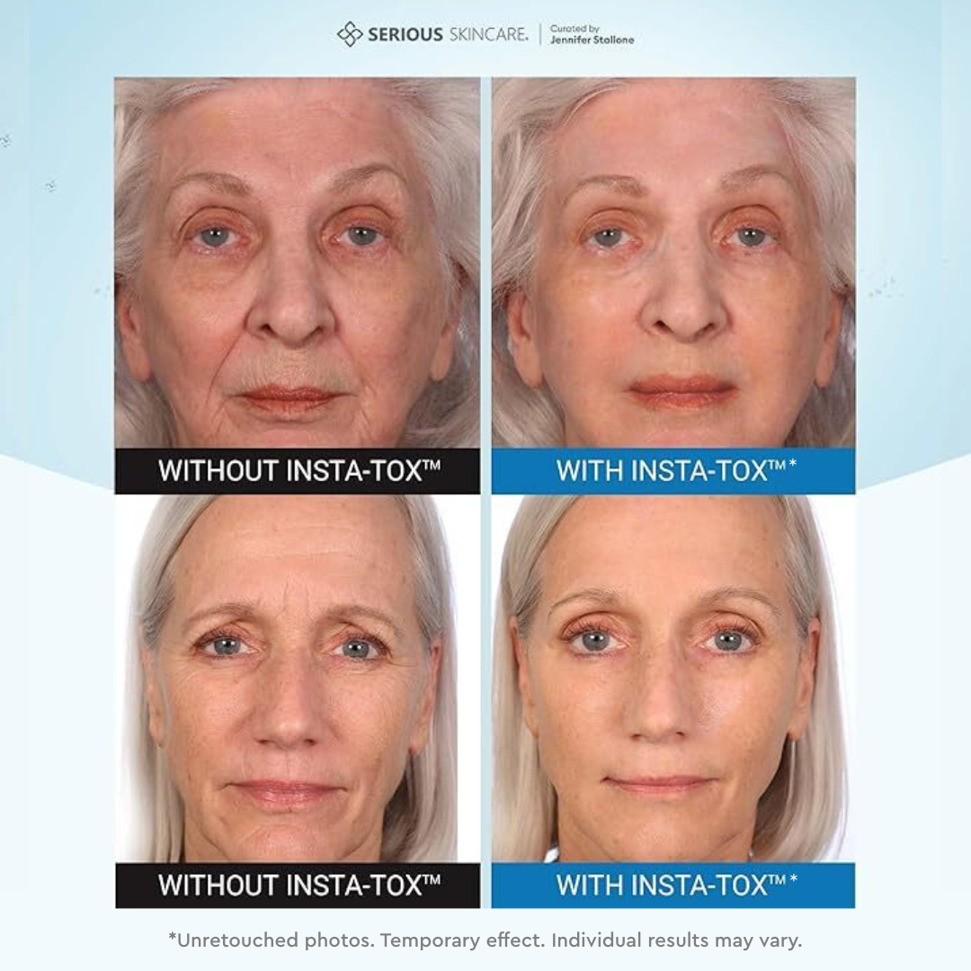 Before and after comparison of a woman's face with and without a skincare treatment labeled 'Insta-Tox'.  Serious Skincare.  Temporary. Targeted. Facial Firming Wrinkle Smoothing Serum.  Alternative to botox.  