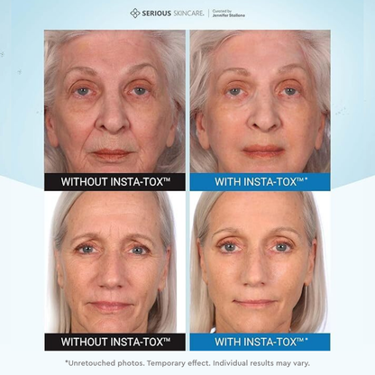 Before and after comparison of a woman's face with and without a skincare treatment labeled 'Insta-Tox'.  Serious Skincare.  Temporary. Targeted. Facial Firming Wrinkle Smoothing Serum.  Alternative to botox.  