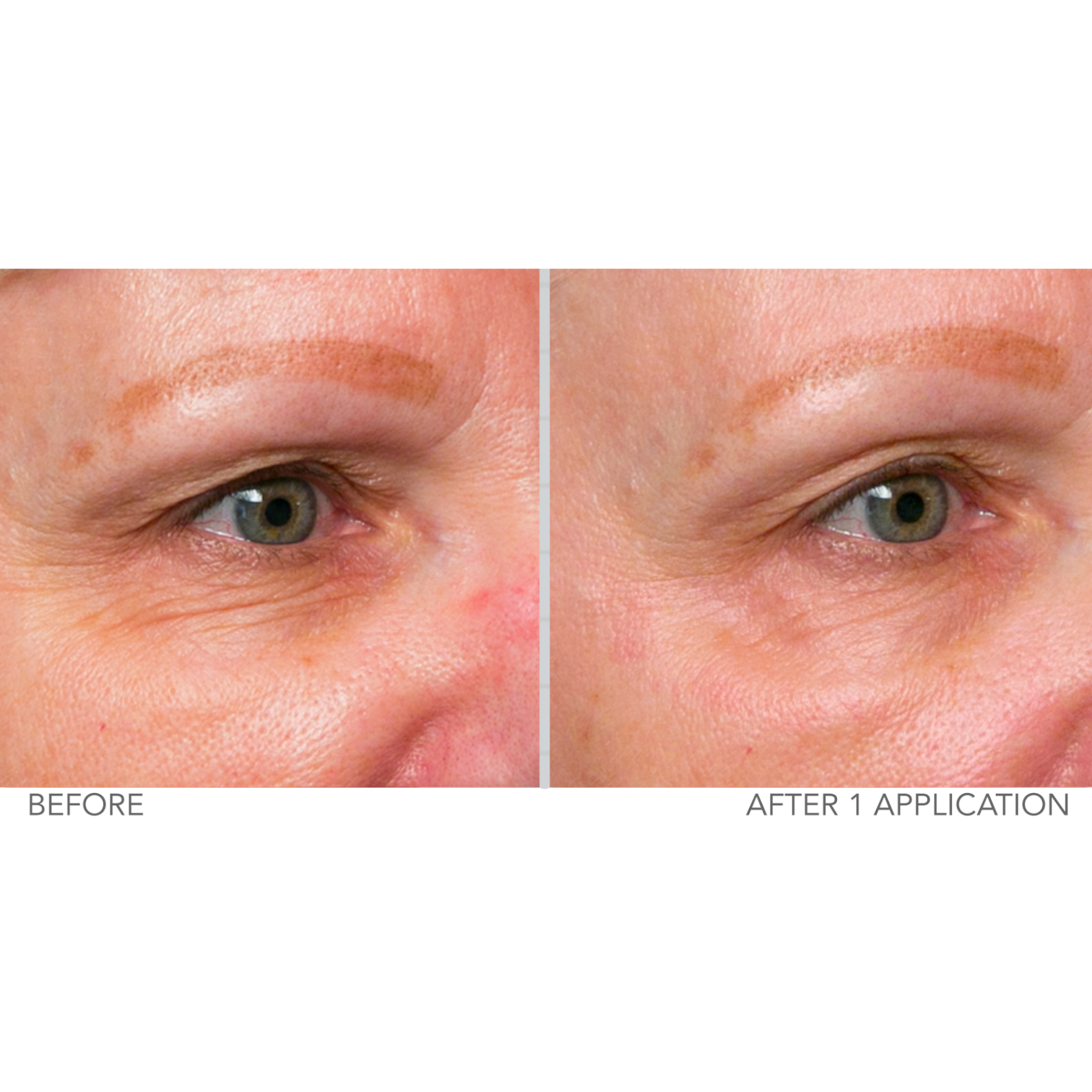 Serious Skincare C Extreme Maxi Filler targeted wrinkle treatment with Vitamin C for lines and wrinkles