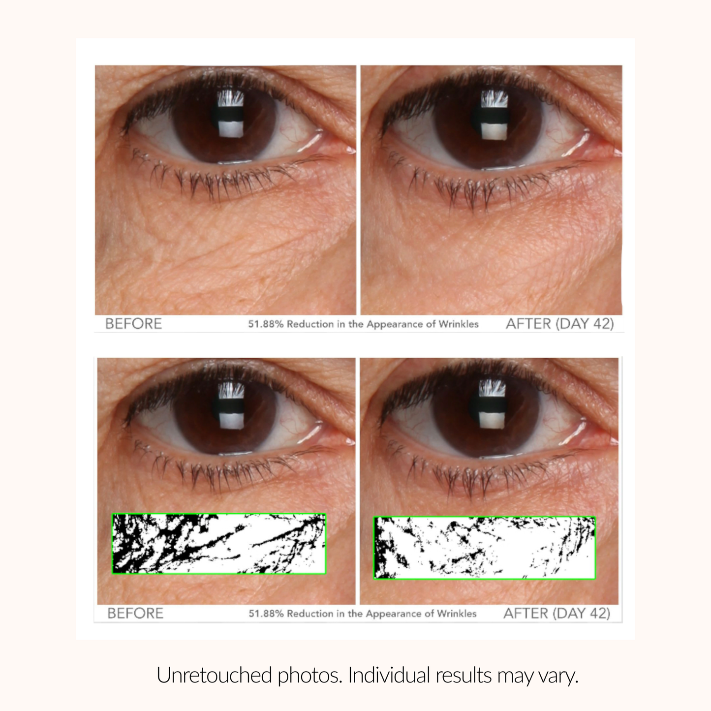Serious Skincare C Eye Vitamin C Eye Cream to brighten, hydrate and smooth the delicate eye area while reducing the look of fine lines, wrinkles and signs of aging.