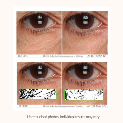 Serious Skincare C Eye Vitamin C Eye Cream to brighten, hydrate and smooth the delicate eye area while reducing the look of fine lines, wrinkles and signs of aging.