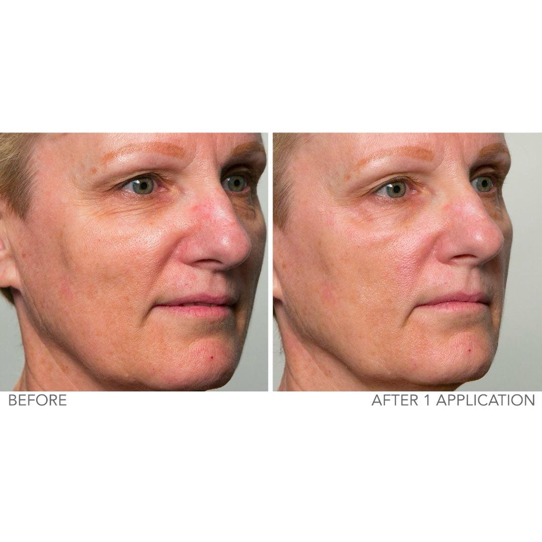 Serious Skincare C Extreme Maxi Filler targeted wrinkle treatment with Vitamin C for lines and wrinkles