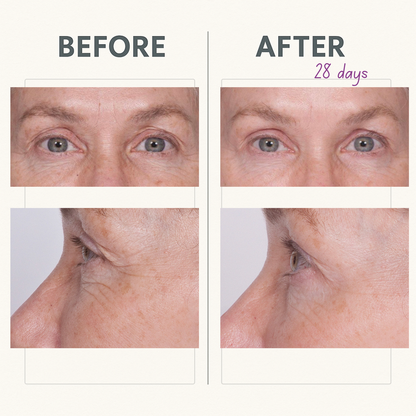 CORREC-CHIN™ INTENSE + Reverse Eye
