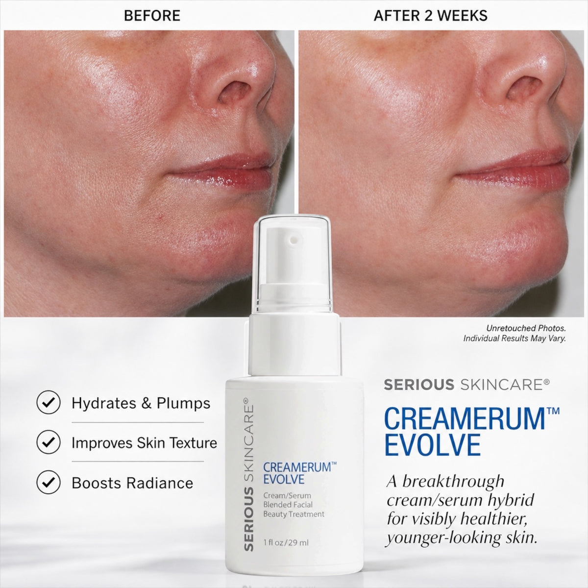 Serious Skincare Creamerum Evolve Serum Cream anti-aging treatment to hydrate, smooth, firm and improve the look of fine lines, wrinkles and aging skin.