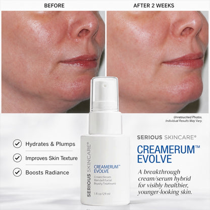 Serious Skincare Creamerum Evolve Serum Cream anti-aging treatment to hydrate, smooth, firm and improve the look of fine lines, wrinkles and aging skin.