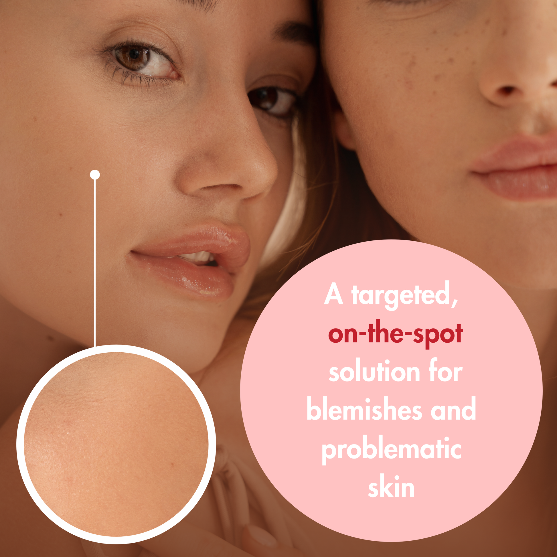 Close-up of two women's faces with a focus on skin texture, accompanied by text about a targeted solution for blemishes.
