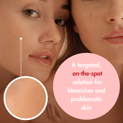 Close-up of two women's faces with a focus on skin texture, accompanied by text about a targeted solution for blemishes.