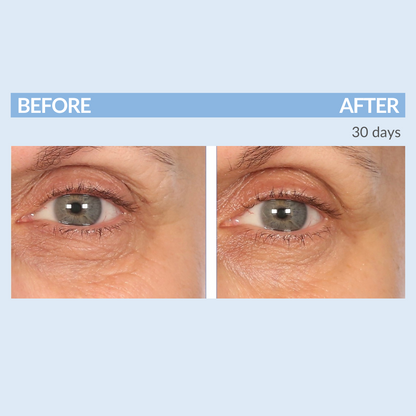 Eyetality Total Eye Care AM & PM with Tray