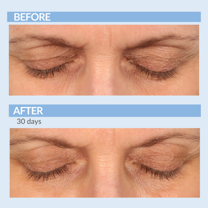 Eyetality Total Eye Care AM & PM with Tray